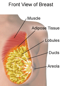 Front view of female breast anatomy with a lump present, Stock